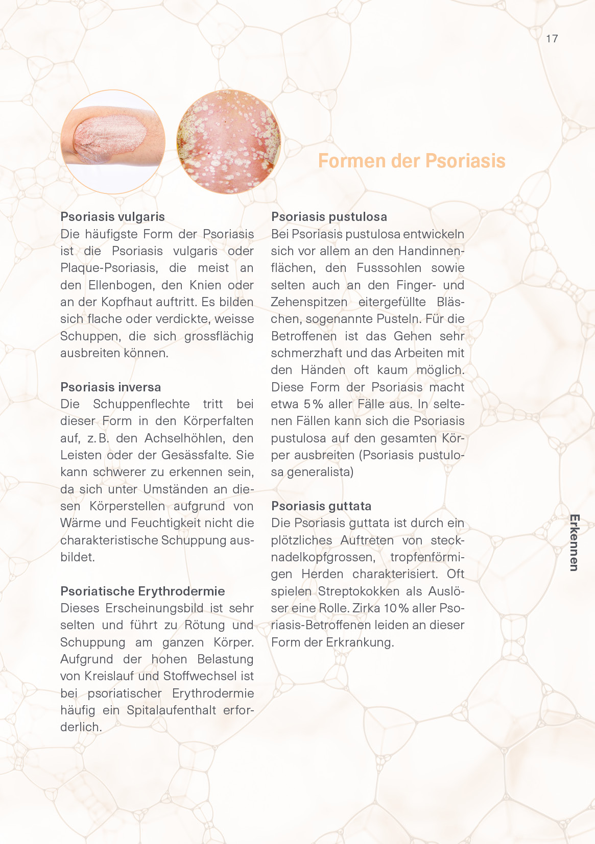 09_2025 AbbVie CH Psoriasis Patientenbroschüre Update_A5_v4_17
